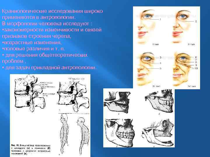 Краниологические исследования широко применяются в антропологии. В морфологии человека исследуют : • закономерности изменчивости
