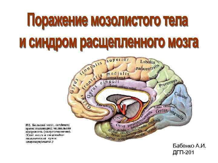 Бабенко А. И. ДГП-201 