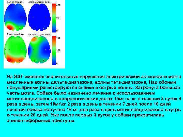 На ЭЭГ имеются значительные нарушения электрической активности мозга медленные волны дельта-диапазона, волны тета-диапазона, Над