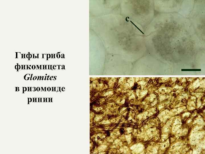 Гифы гриба фикомицета Glomites в ризомоиде ринии 