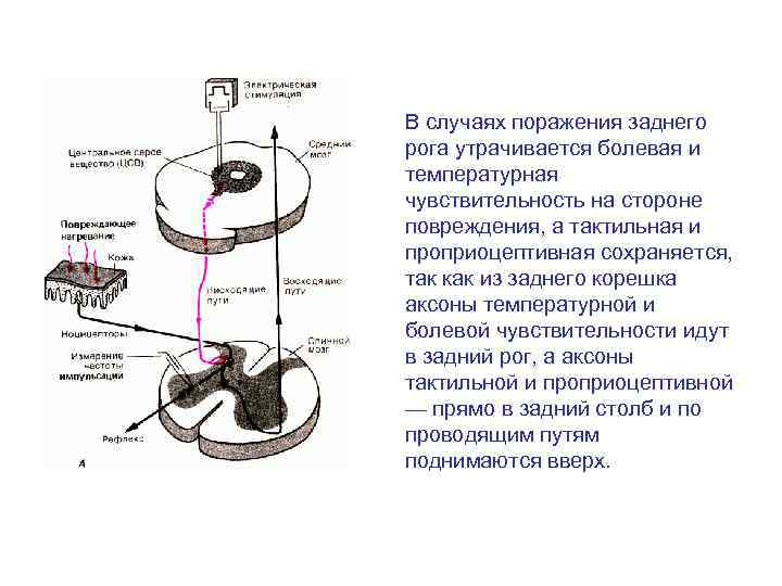 2 нарисовать блок схемы болевого тактильного и проприоцептивного анализаторов