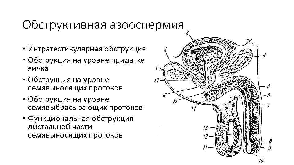 Обструктивная азооспермия • Интратестикулярная обструкция • Обструкция на уровне придатка яичка • Обструкция на