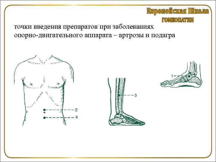 Синдром опорно двигательного аппарата. Синдромы поражения опорно-двигательного аппарата. При травмах и заболеваниях опорно-двигательного аппарата массаж. Точки опорно двигательного аппарата.