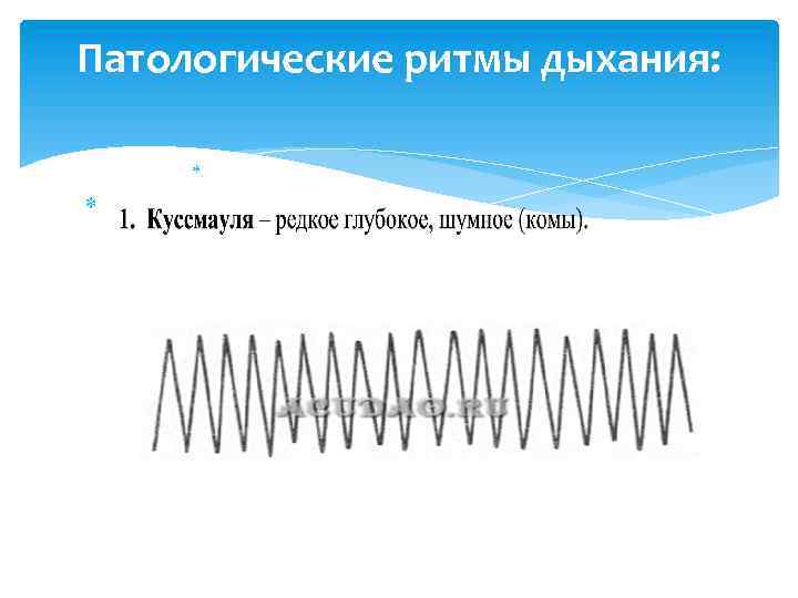 Патологические ритмы дыхания: 