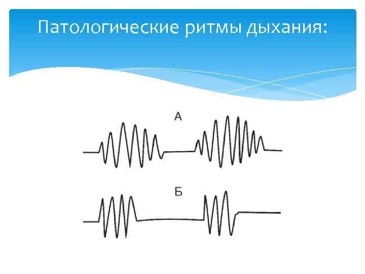 Патологические ритмы дыхания: 