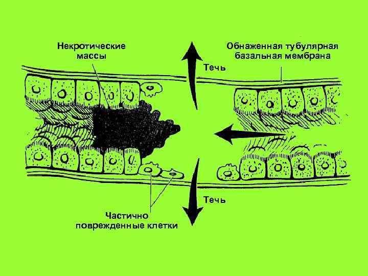 Базальная мембрана функции. Базальная мембрана клетки. Тубулярная базальная мембрана. Базальная мембрана эпителия. Строение базальной мембраны.