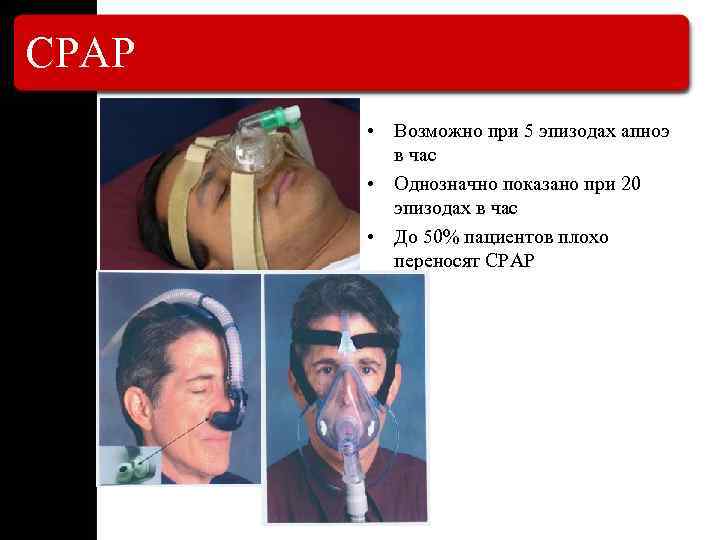 СРАР • Возможно при 5 эпизодах апноэ в час • Однозначно показано при 20