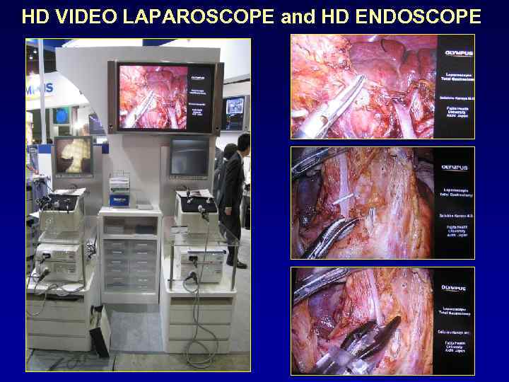 HD VIDEO LAPAROSCOPE and HD ENDOSCOPE 