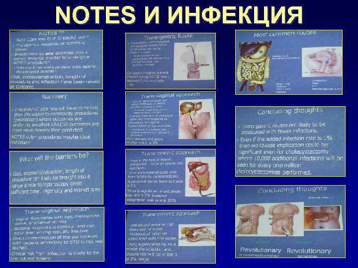 NOTES И ИНФЕКЦИЯ 