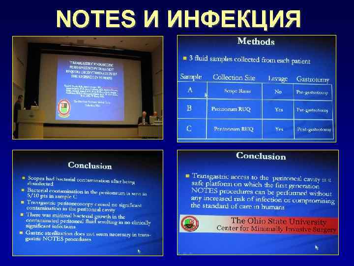 NOTES И ИНФЕКЦИЯ 