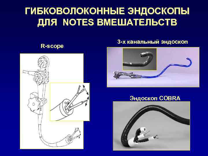 ГИБКОВОЛОКОННЫЕ ЭНДОСКОПЫ ДЛЯ NOTES ВМЕШАТЕЛЬСТВ R-scope 3 -х канальный эндоскоп Эндоскоп COBRA 