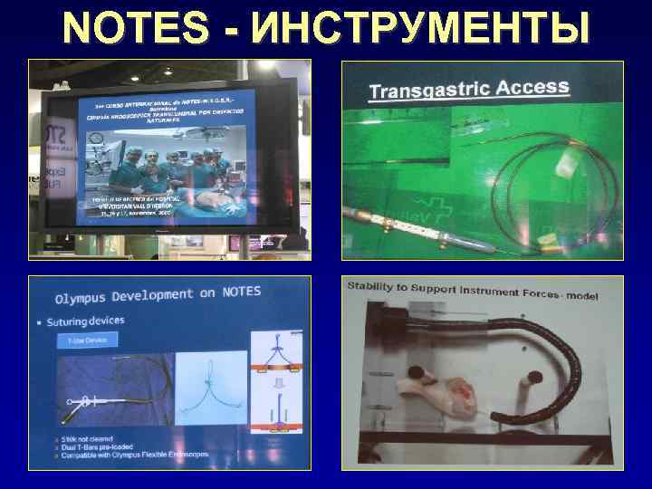 NOTES - ИНСТРУМЕНТЫ 