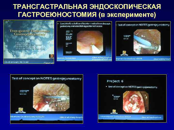 ТРАНСГАСТРАЛЬНАЯ ЭНДОСКОПИЧЕСКАЯ ГАСТРОЕЮНОСТОМИЯ (в эксперименте) 