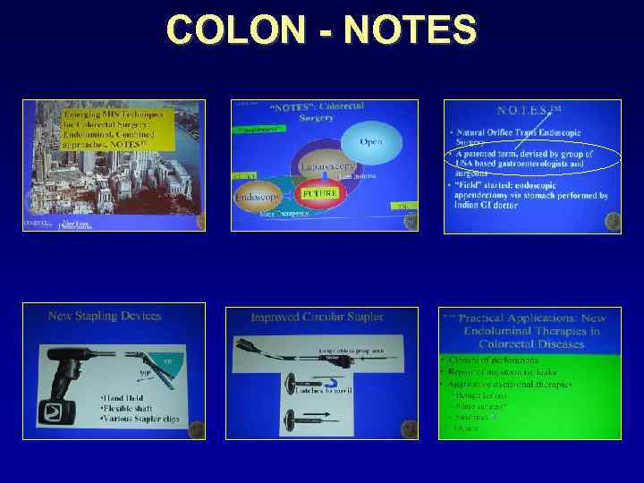 COLON - NOTES 