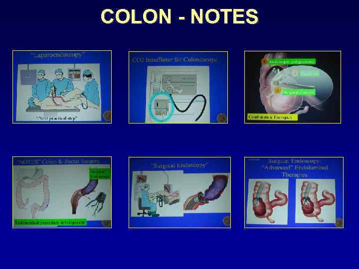 COLON - NOTES 