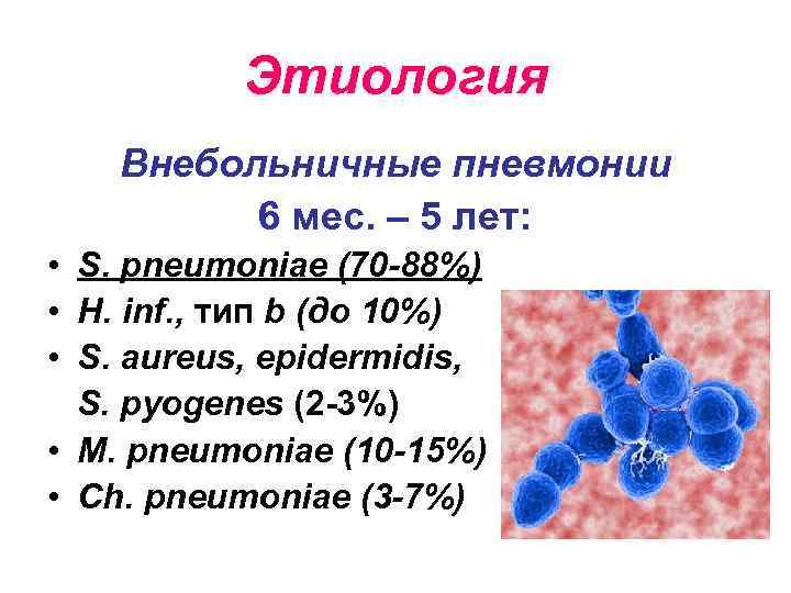 Этиология Внебольничные пневмонии 6 мес. – 5 лет: • S. pneumoniae (70 -88%) •