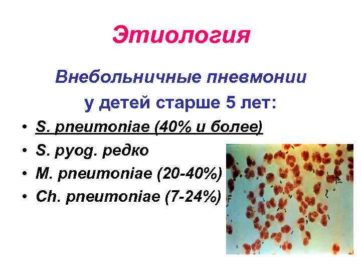 Как не пропустить пневмонию у ребенка. Этиология внебольничной пневмонии у детей. Этиология внебольничной пневмонии. Возбудители внебольничной пневмонии у детей. Возбудитель пневмонии у детей старше 5 лет.