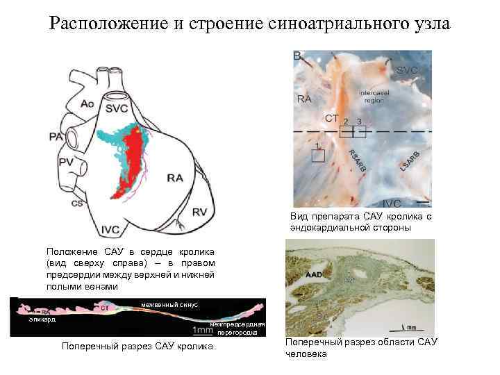 Расположение и строение синоатриального узла Вид препарата САУ кролика с эндокардиальной стороны Положение САУ