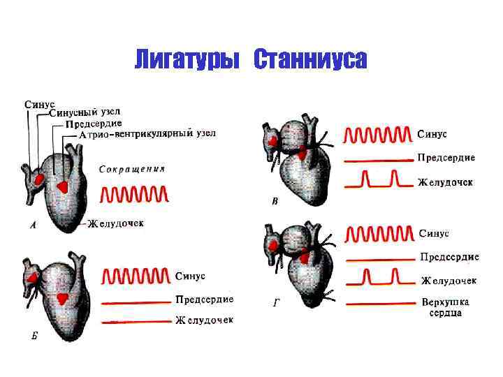 Лигатуры Станниуса 