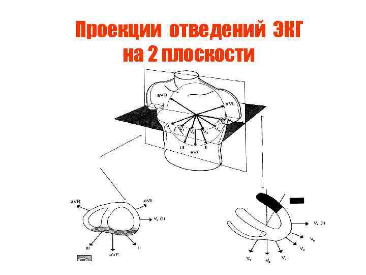 Проекции отведений ЭКГ на 2 плоскости 