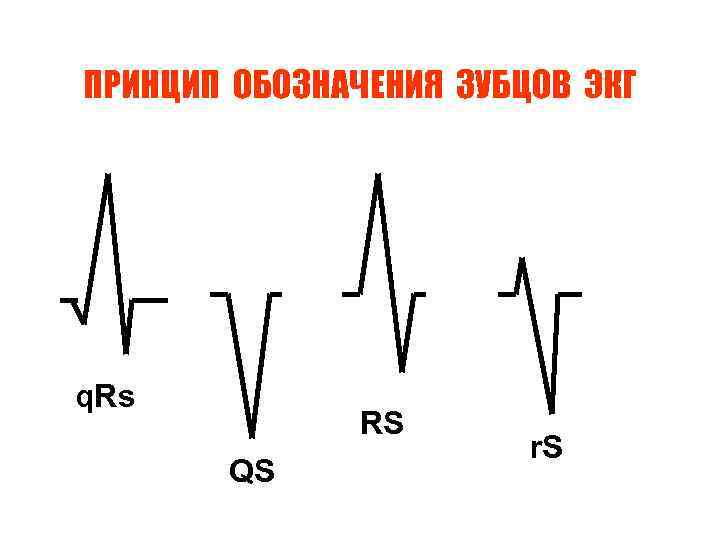 ПРИНЦИП ОБОЗНАЧЕНИЯ ЗУБЦОВ ЭКГ q. Rs RS QS r. S 