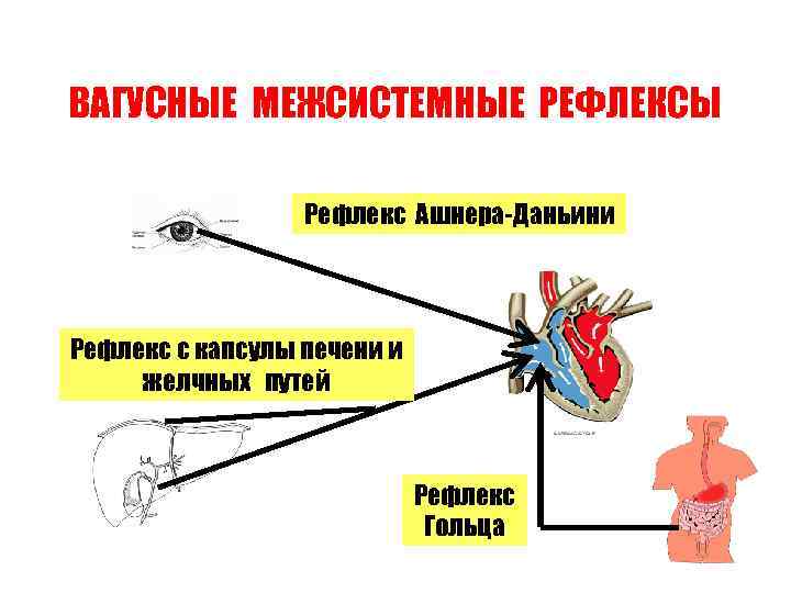 ВАГУСНЫЕ МЕЖСИСТЕМНЫЕ РЕФЛЕКСЫ Рефлекс Ашнера-Даньини Рефлекс с капсулы печени и желчных путей Рефлекс Гольца