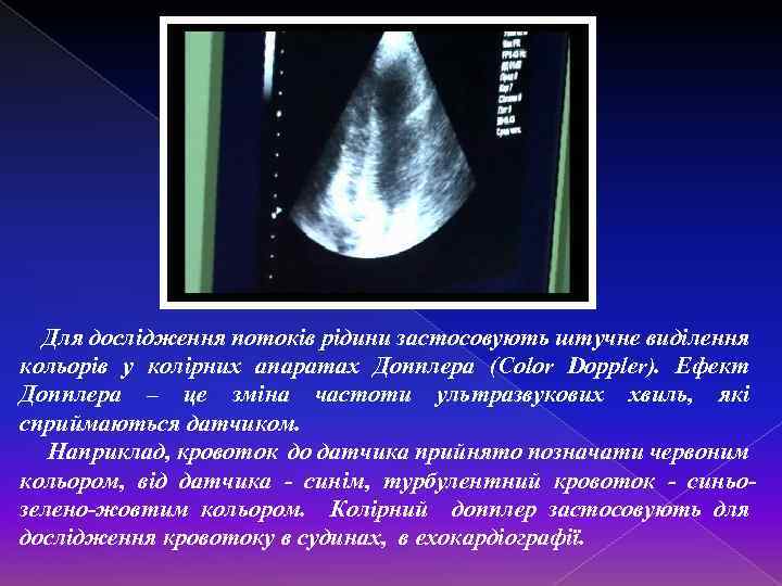 Для дослідження потоків рідини застосовують штучне виділення кольорів у колірних апаратах Допплера (Color Doppler).