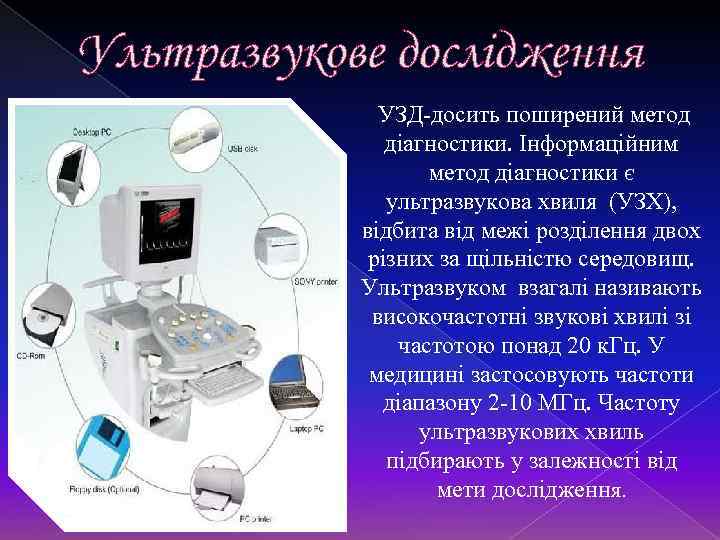 Ультразвукове дослідження УЗД-досить поширений метод діагностики. Інформаційним метод діагностики є ультразвукова хвиля (УЗХ), відбита