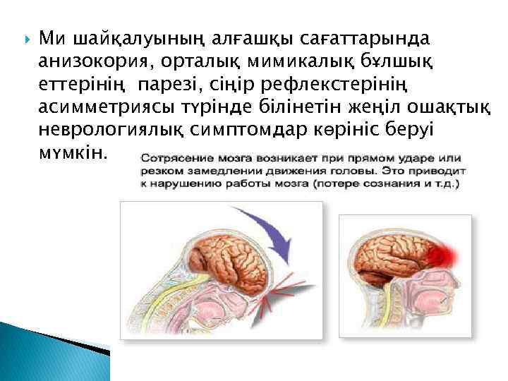  Ми шайқалуының алғашқы сағаттарында анизокория, орталық мимикалық бұлшық еттерінің парезі, сіңір рефлекстерінің асимметриясы