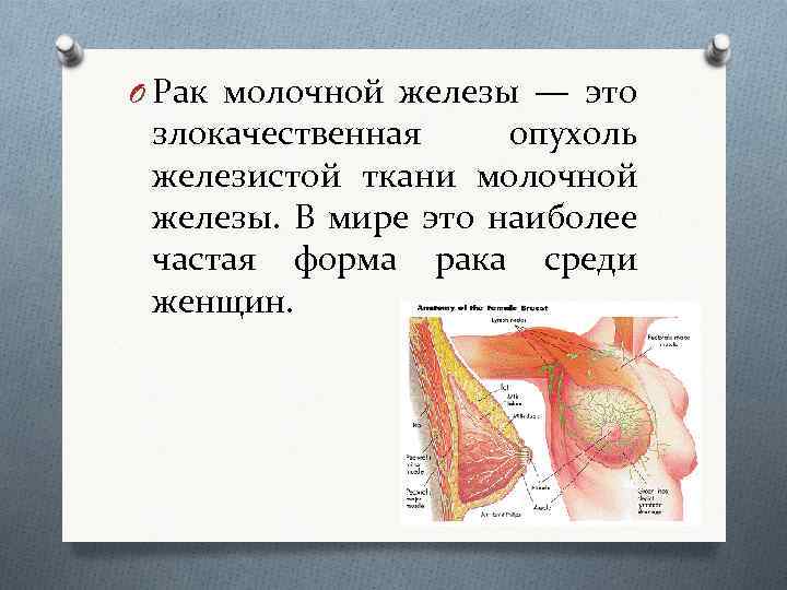 O Рак молочной железы — это злокачественная опухоль железистой ткани молочной железы. В мире