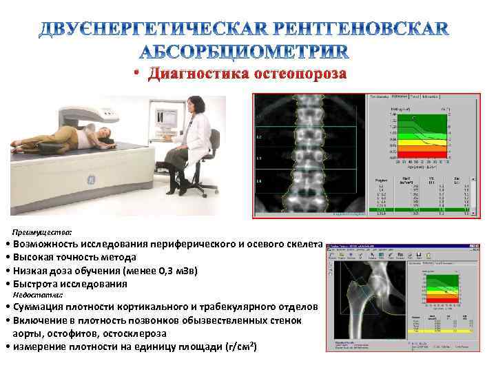  • Диагностика остеопороза Преимущества: • Возможность исследования периферического и осевого скелета • Высокая