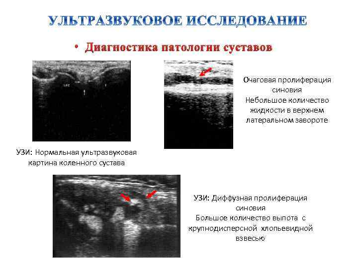 Узи суставов в минске