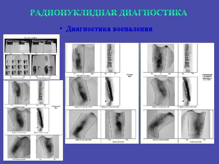  • Диагностика воспаления 