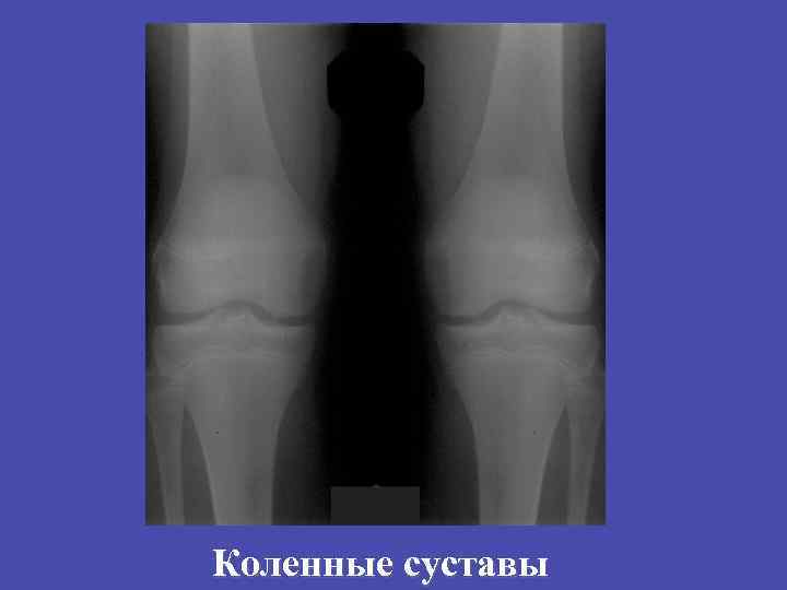 Коленные суставы 