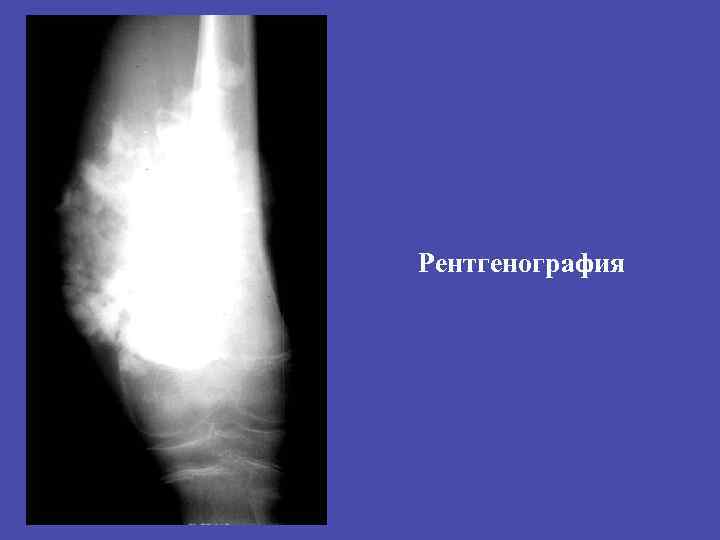 Рентгенография 