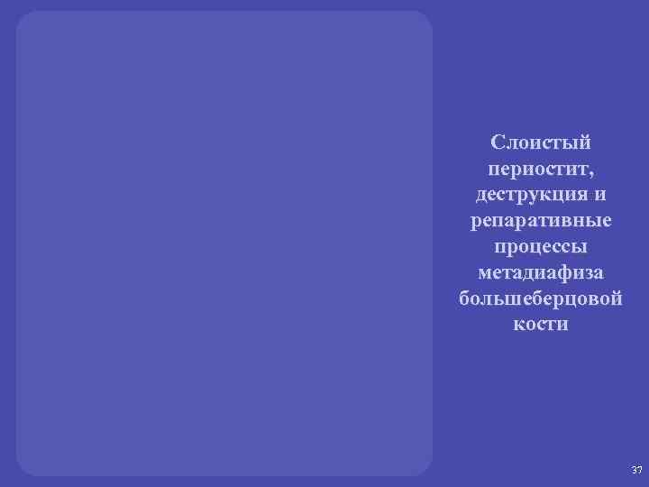 Слоистый периостит, деструкция и репаративные процессы метадиафиза большеберцовой кости 37 