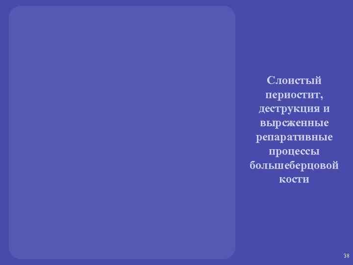 Слоистый периостит, деструкция и вырсженные репаративные процессы большеберцовой кости 38 