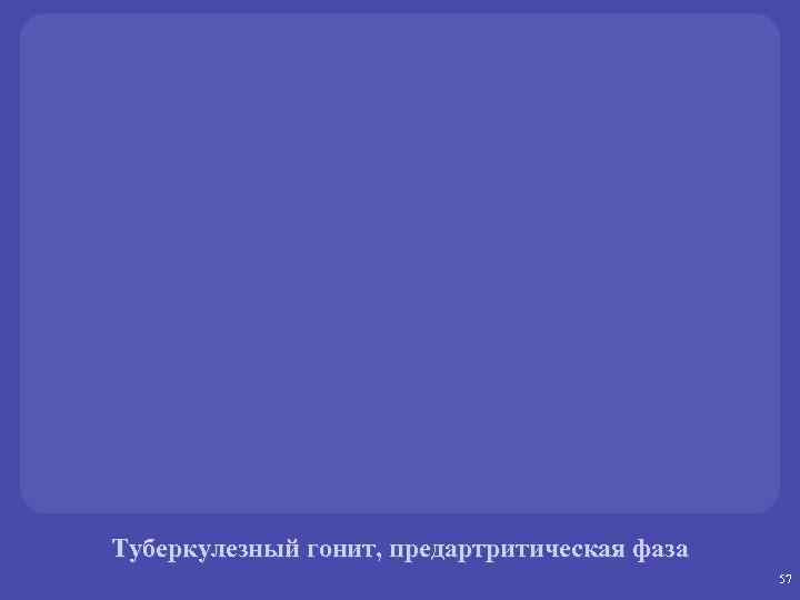 Туберкулезный гонит, предартритическая фаза 57 