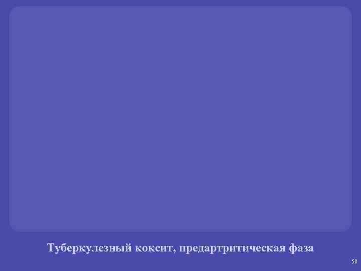 Туберкулезный коксит, предартритическая фаза 58 