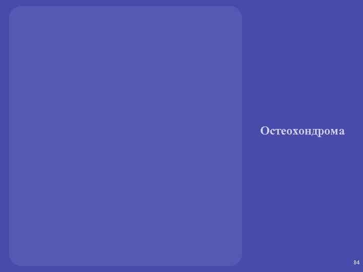 Остеохондрома 84 