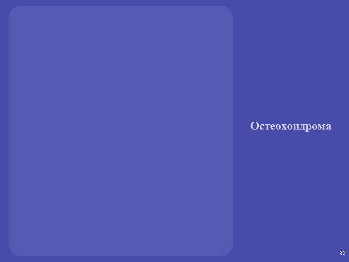 Остеохондрома 85 