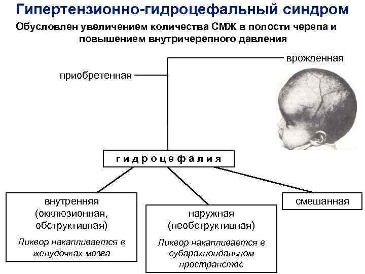 Гидроцефалия головного мозга у взрослого. Гидроцефалия Тип наследования. Гидроцефально-гипертензионный синдром. Обтурационная гидроцефалия Тип наследования. Гидроцефалия этиология.