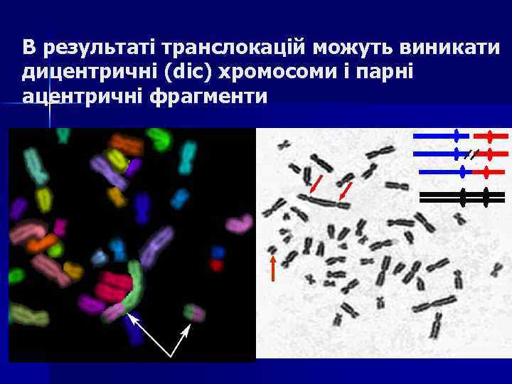 В результаті транслокацій можуть виникати дицентричні (dic) хромосоми і парні ацентричні фрагменти 