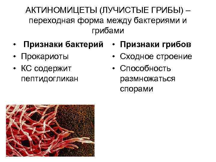 АКТИНОМИЦЕТЫ (ЛУЧИСТЫЕ ГРИБЫ) – переходная форма между бактериями и грибами • Признаки бактерий •