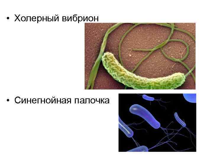  • Холерный вибрион • Синегнойная палочка 