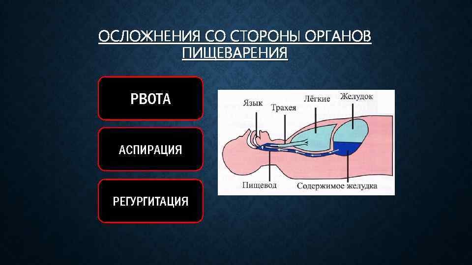 ОСЛОЖНЕНИЯ СО СТОРОНЫ ОРГАНОВ ПИЩЕВАРЕНИЯ РВОТА АСПИРАЦИЯ РЕГУРГИТАЦИЯ 