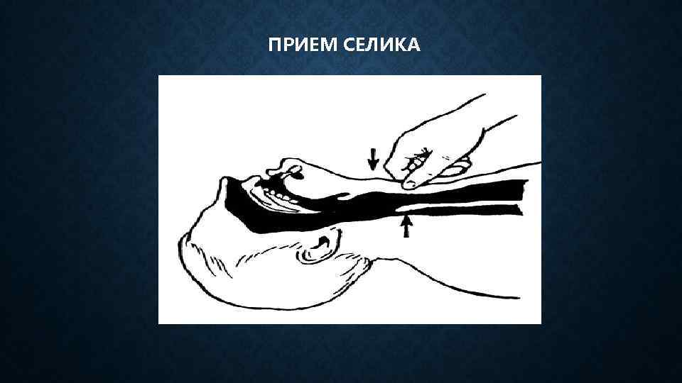 ПРИЕМ СЕЛИКА 