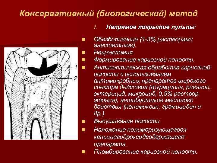 Консервативный (биологический) метод I. n n n n Непрямое покрытие пульпы: Обезболивание (1 -3%