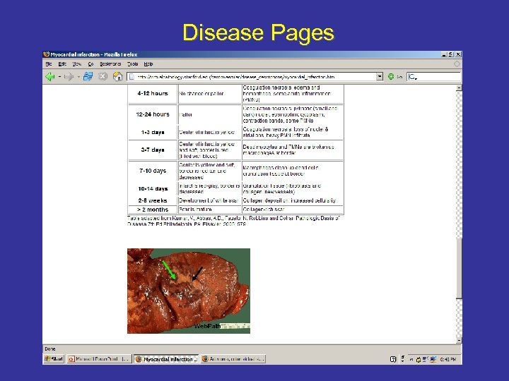 Disease Pages 