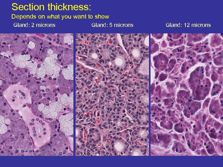 Section thickness: Depends on what you want to show Gland: 2 microns Gland: 5